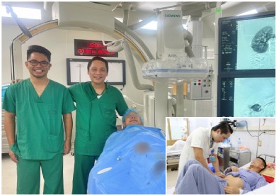 Nút mạch điều trị dị dạng thông động tĩnh mạch thận phải ''khổng lồ'' hiếm gặp