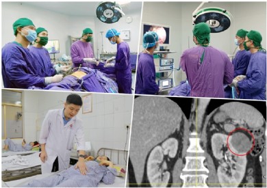 Bệnh viện Đa khoa tỉnh Quảng Ninh phẫu thuật nội soi cắt thận bán phần điều trị triệt căn ung thư