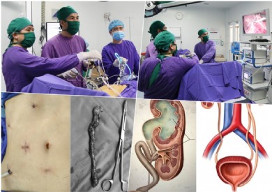 Phẫu thuật nội soi cắt thận phụ và niệu quản lạc chỗ, xóa tan nỗi khổ khó nói cho người bệnh
