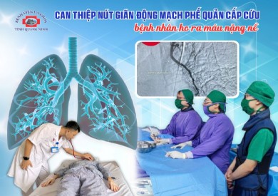 Can thiệp nút giãn động mạch phế quản cứu bệnh nhân tim mạch ho ra máu nặng nề