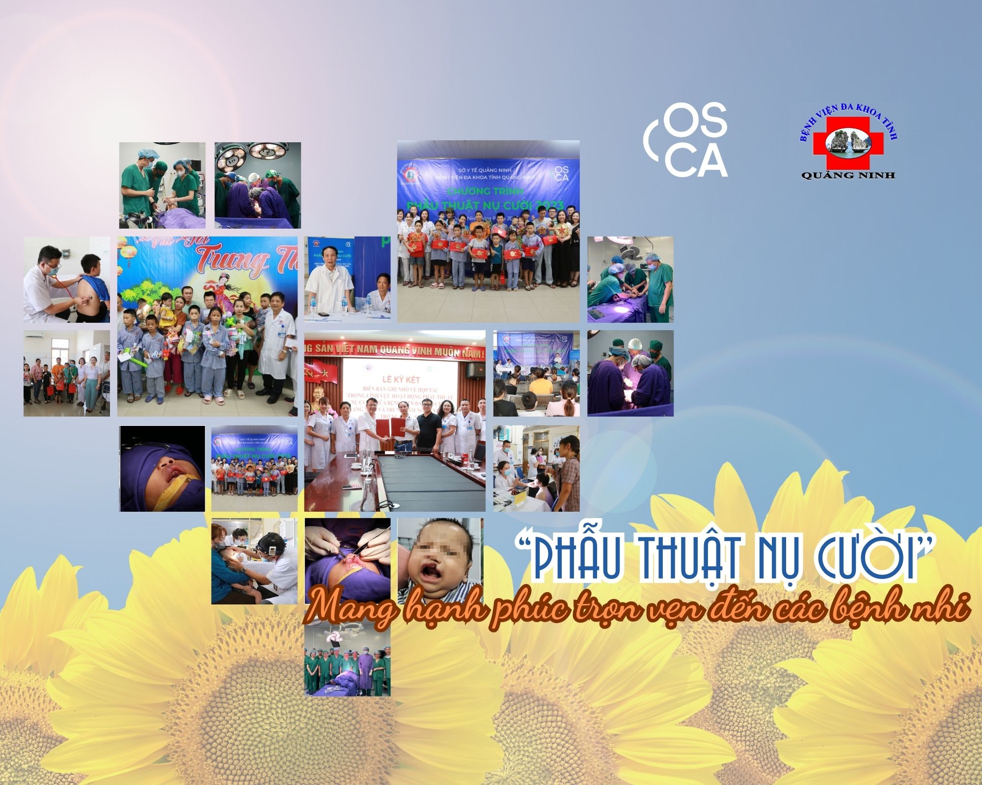 Phẫu thuật miễn phí cho bệnh nhi dị tật khe hở môi, vòm miệng